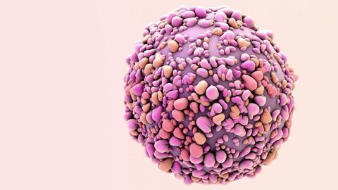 Survival Boosted by 24% Using Precision Drug Combo in Younger Women With Advanced Breast Cancer
