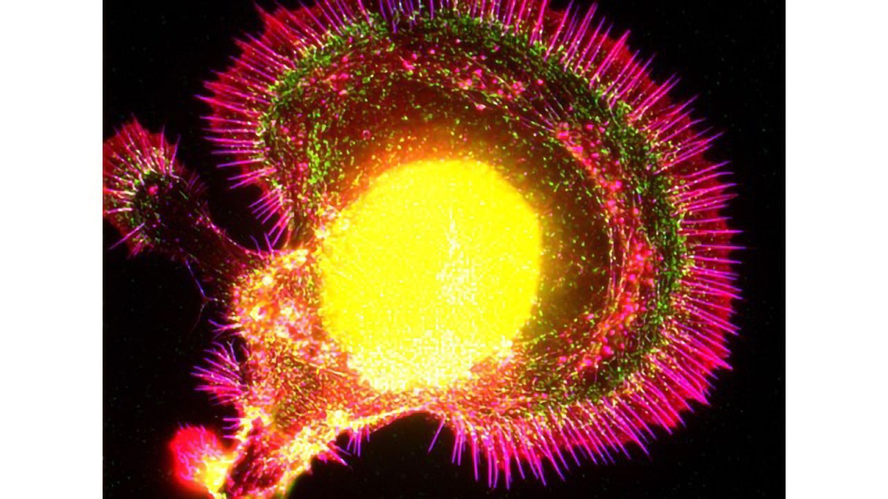 Fluorescence micrograph of a neuron regenerating in culture.