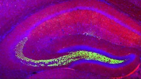 Exercise Helps Eliminate Behavioral Differences in Mouse Model of Autism