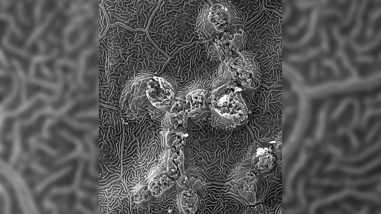 Immune Cells Breach “Barrier” to Access Skin Cancer Cells