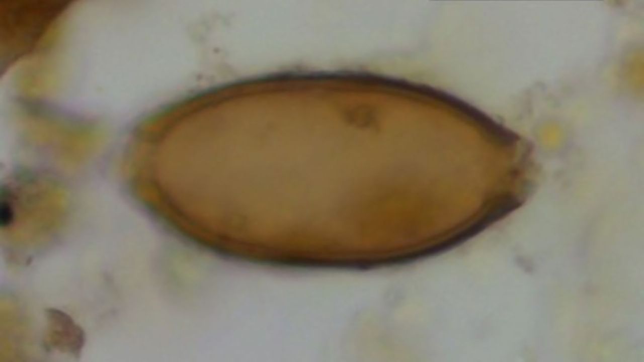 Ancient Feces Reveals Ancient Parasites