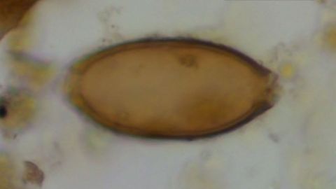 Ancient Feces Reveals Ancient Parasites