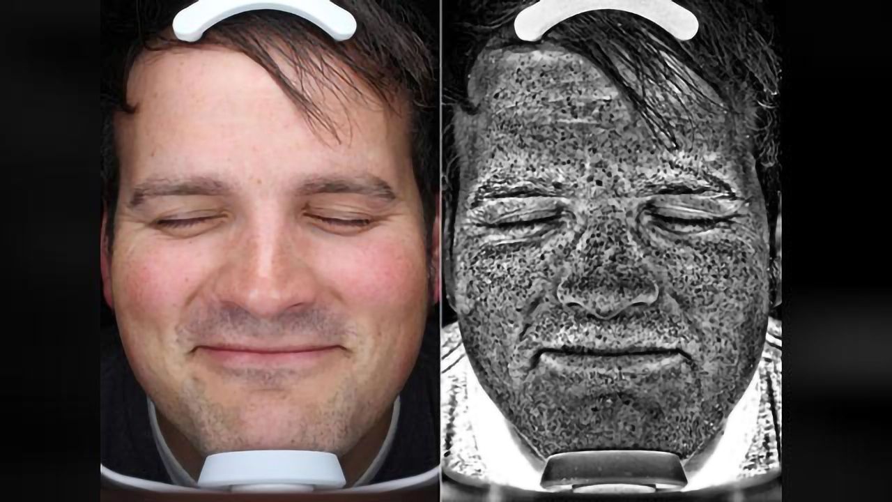 What If You Could Spot Skin Cancer Before It Got Too Serious?