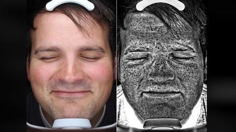 What If You Could Spot Skin Cancer Before It Got Too Serious?