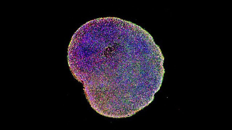 Brain Organoid Boost Replicates Human Cerebral Cortex Growth content piece image