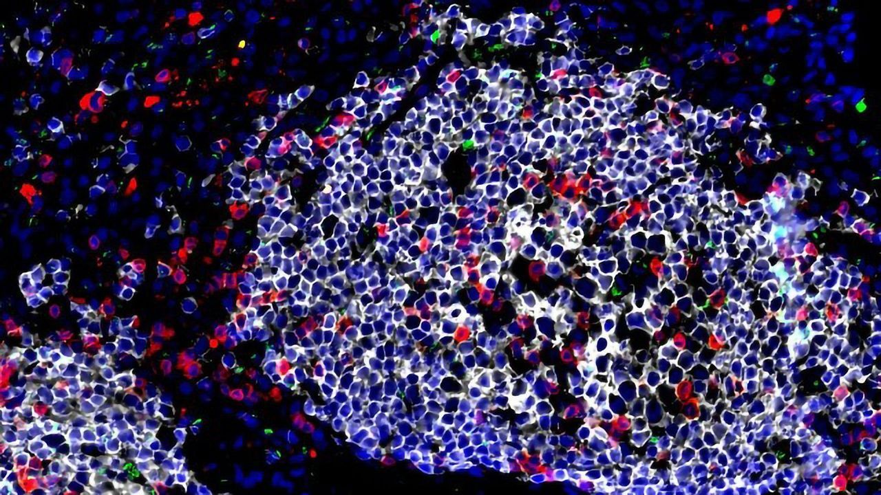 Unexpected Role for Immune Cells in Early TB Infection