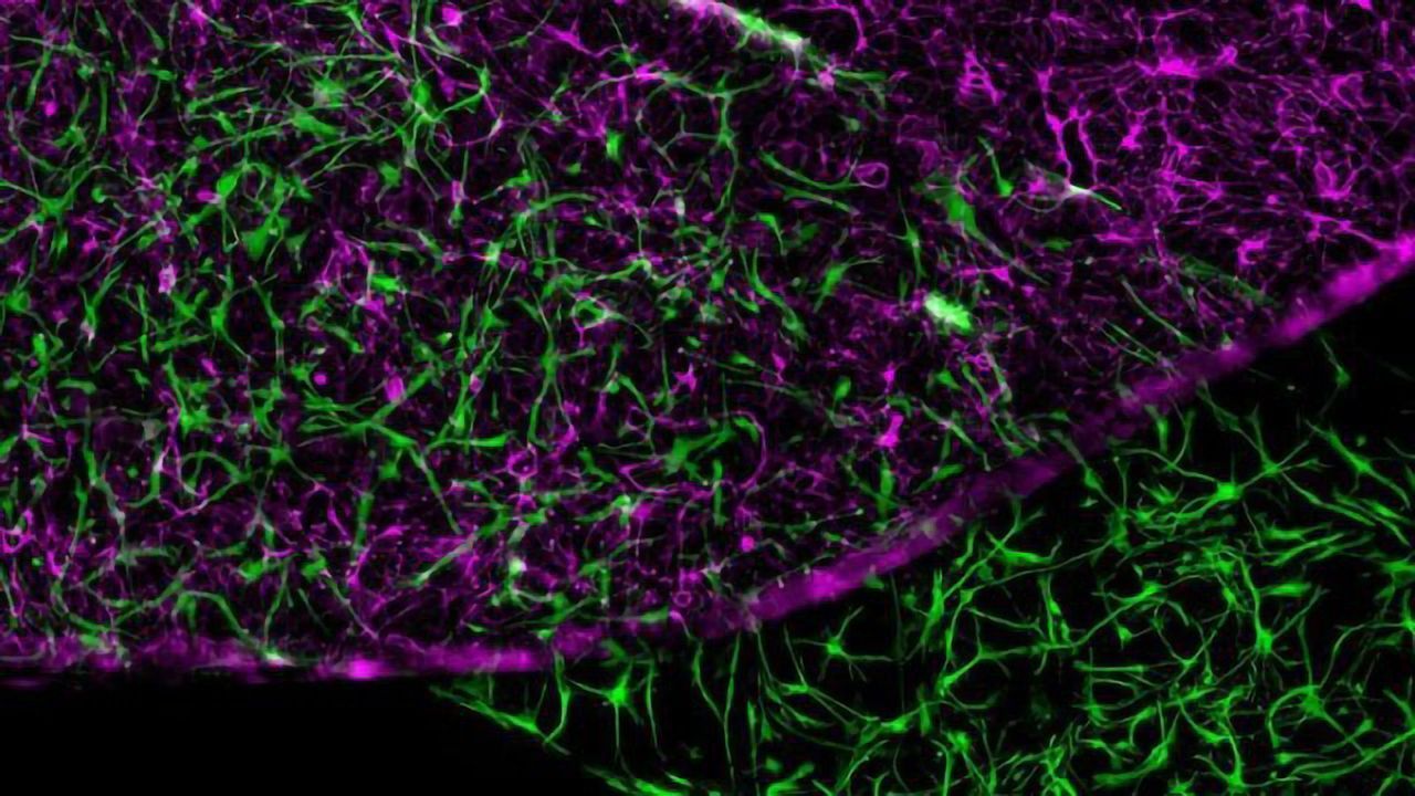 Blood-Brain Barrier Recreated Outside Human Body