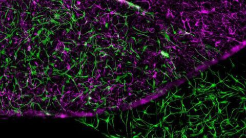 Blood-Brain Barrier Recreated Outside Human Body