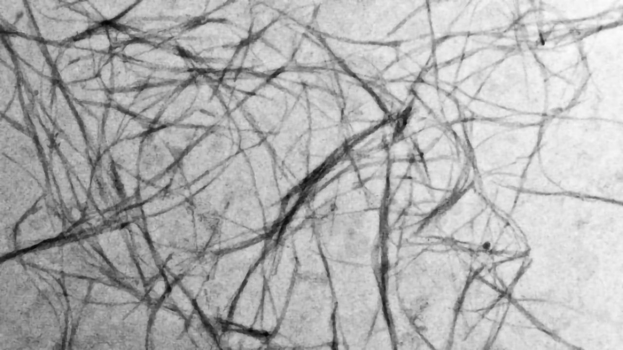 Breaking Down Pathological Protein Aggregates
