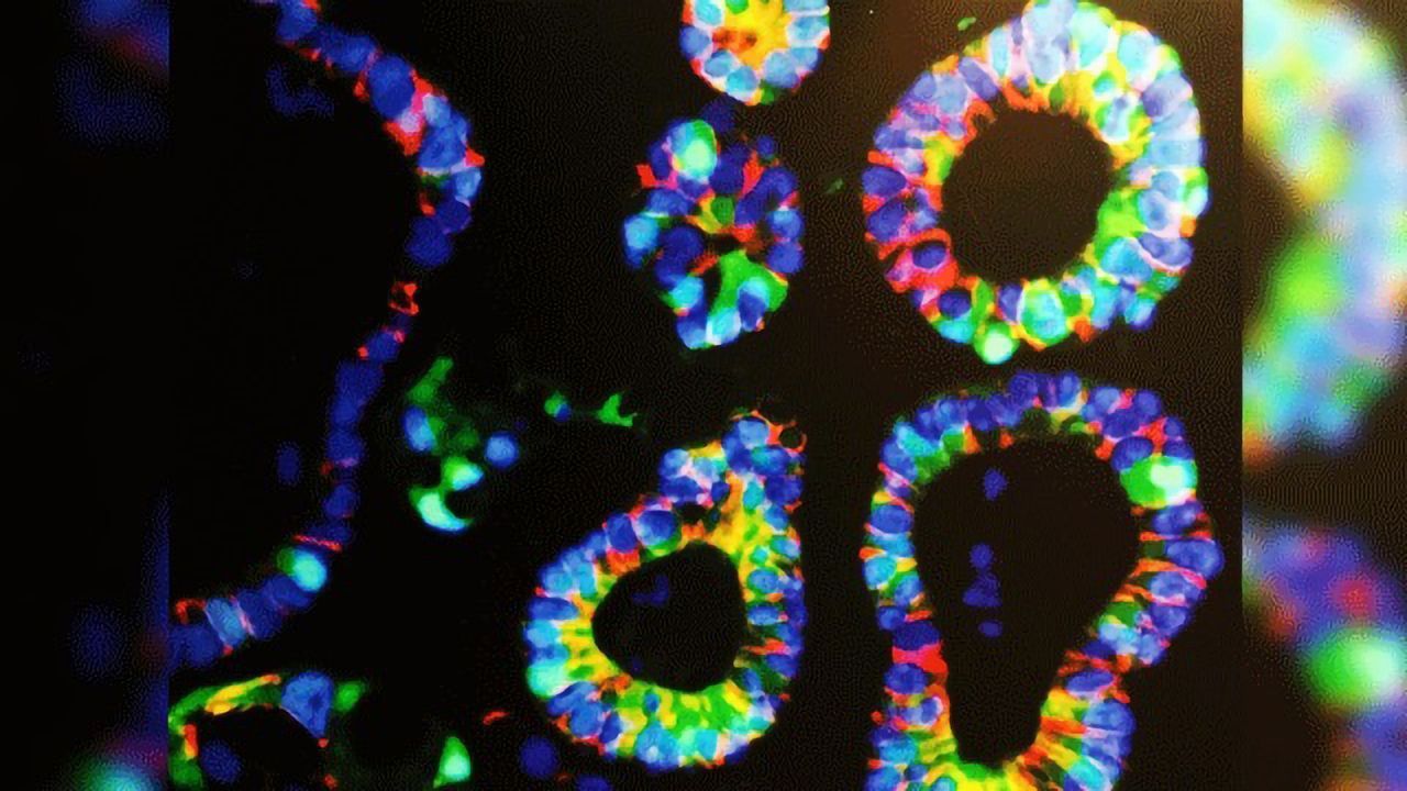 The Big Picture on Growing Small Intestines