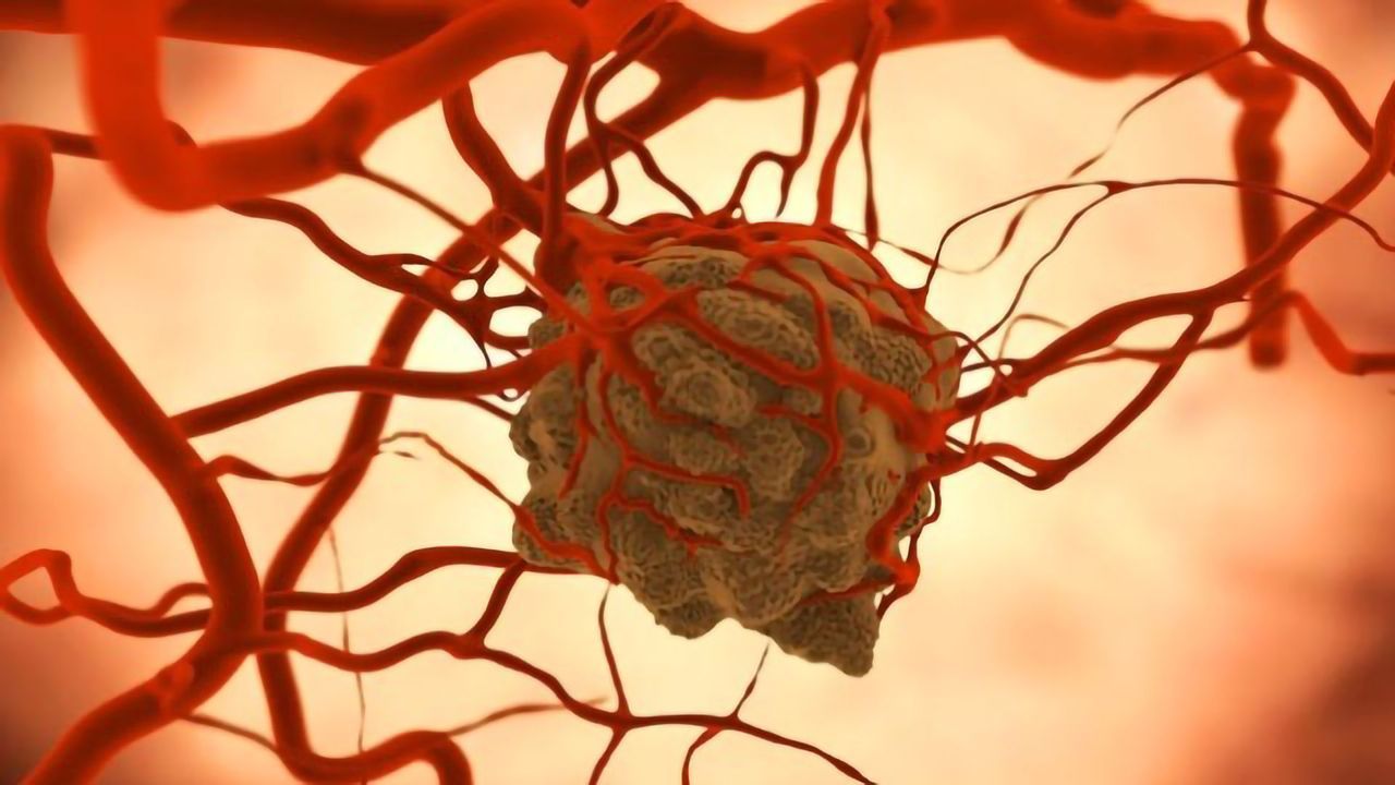 “Chatter” Between Cancer and Immune Cells Makes for a “Hot Tumor”
