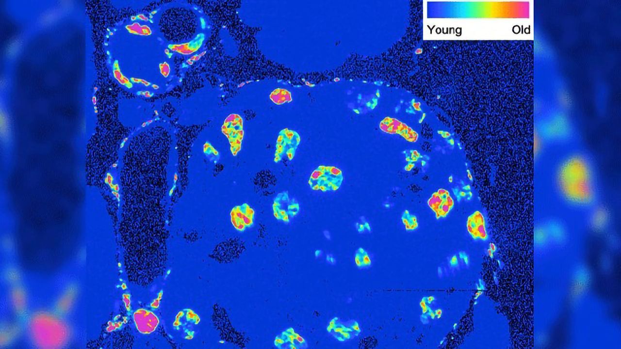 How Old Are Cells Within an Organ?