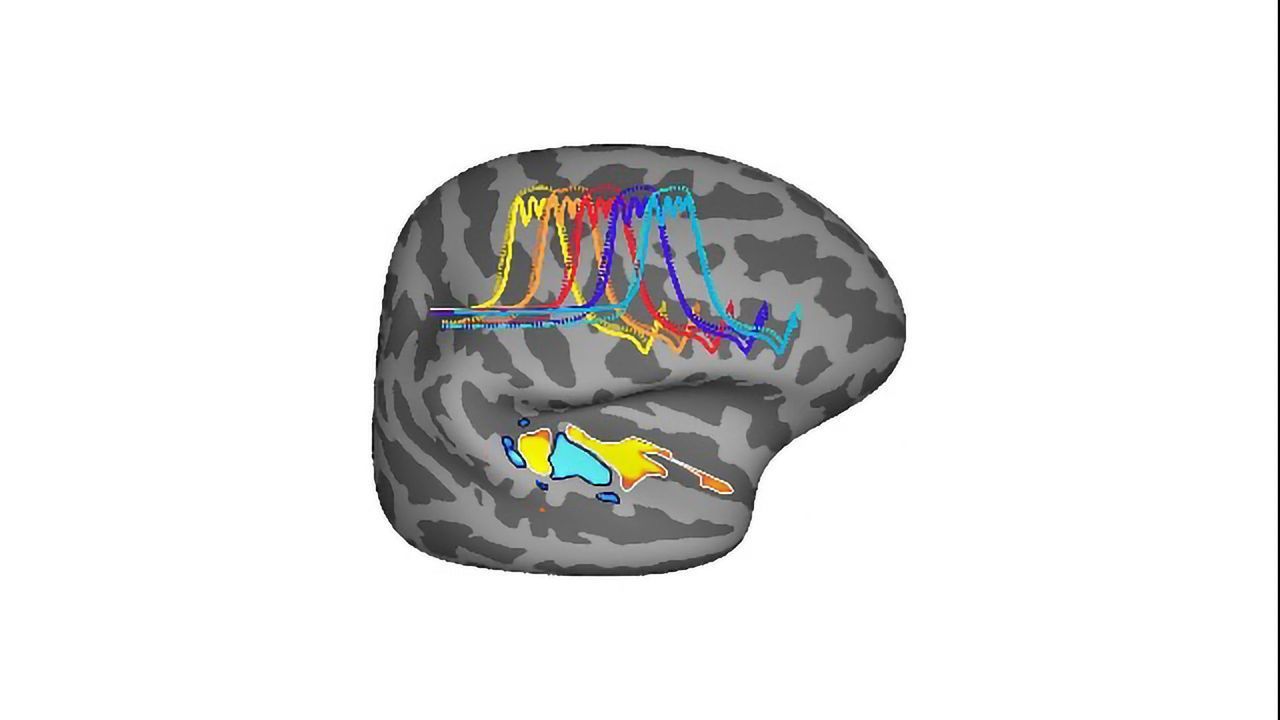 The Human Brain Is Uniquely Tuned for Musical Pitch