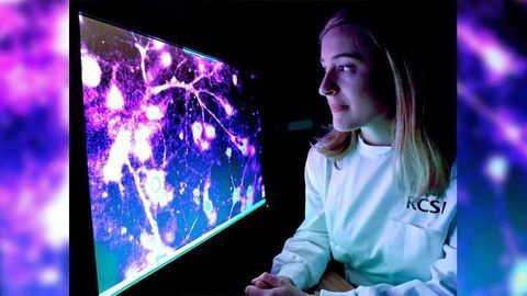 tRNA a Warning System for Oncoming Epileptic Seizures?