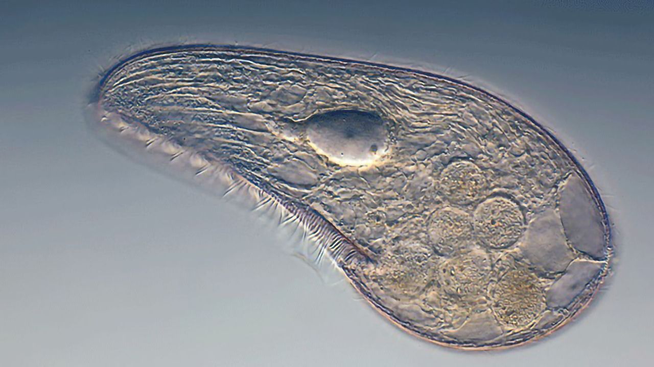 Single-celled Organism Dies
