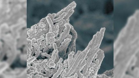 Acne Drug Could Help Combat Hardening of the Arteries