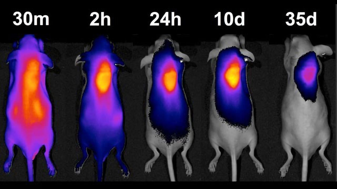 Hydrogel “Homing Beacon” Recruits Drugs to Tumor Target