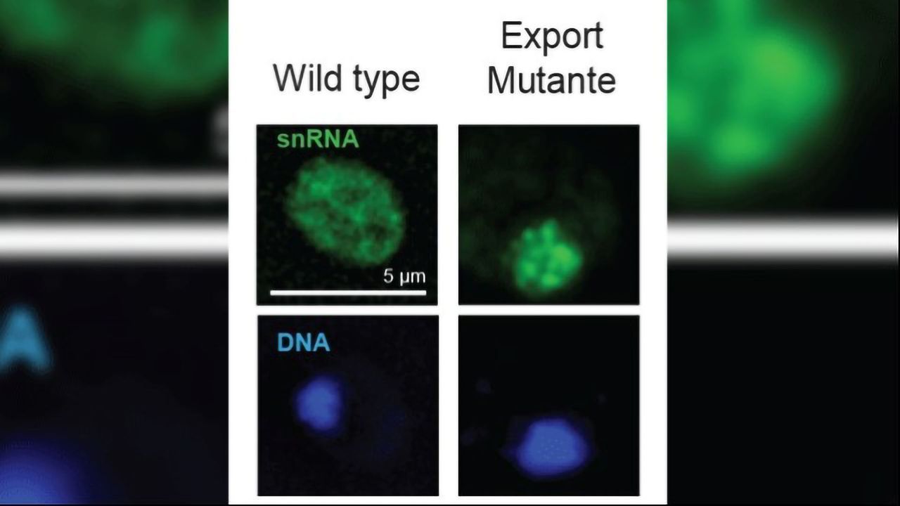 Quality Assurance Step in Gene Expression Clarified in Yeast