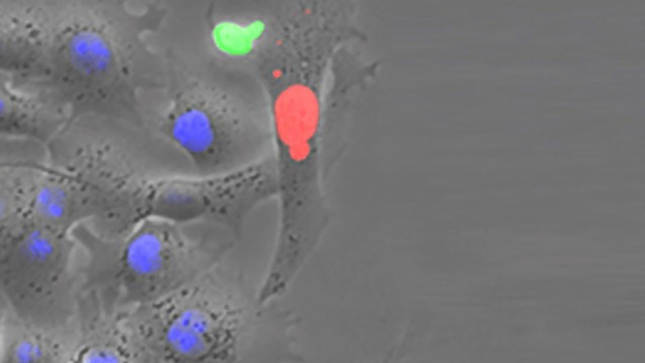 Checkmate for Hepatitis B in the Liver