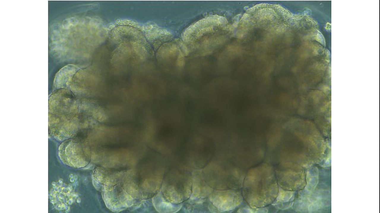 NIAID Scientists Develop “Mini-brain” Model of Human Prion Disease