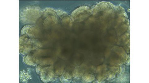 NIAID Scientists Develop “Mini-brain” Model of Human Prion Disease