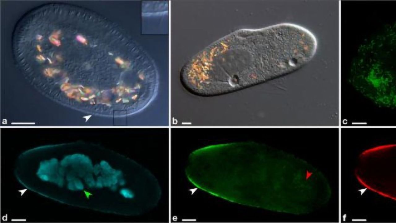 Predatory Extracellular Rickettsia-like Bacteria Discovered