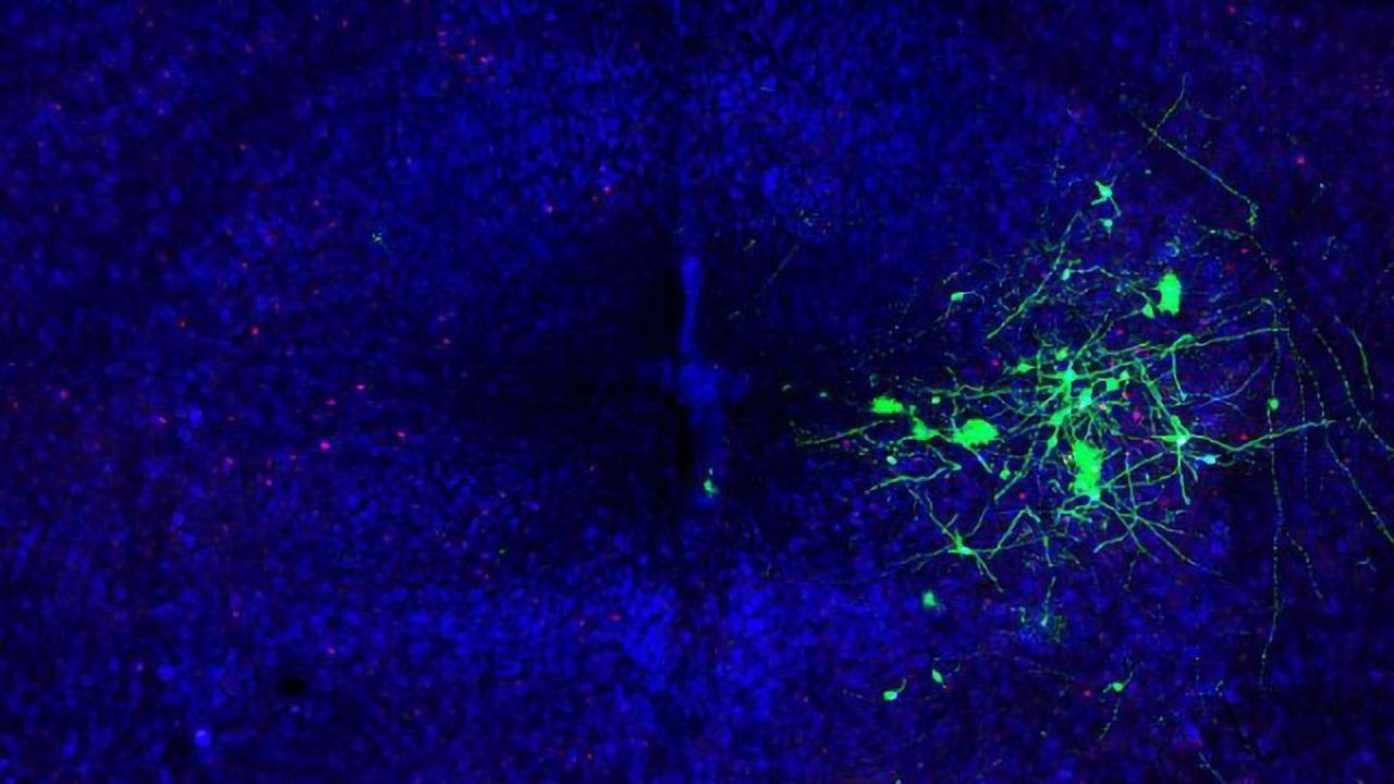 The Neurons Behind Mouse Song