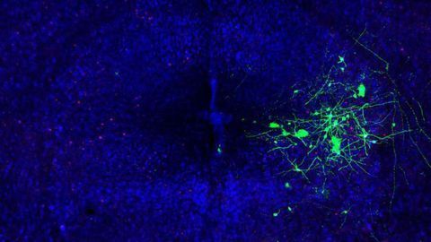 The Neurons Behind Mouse Song
