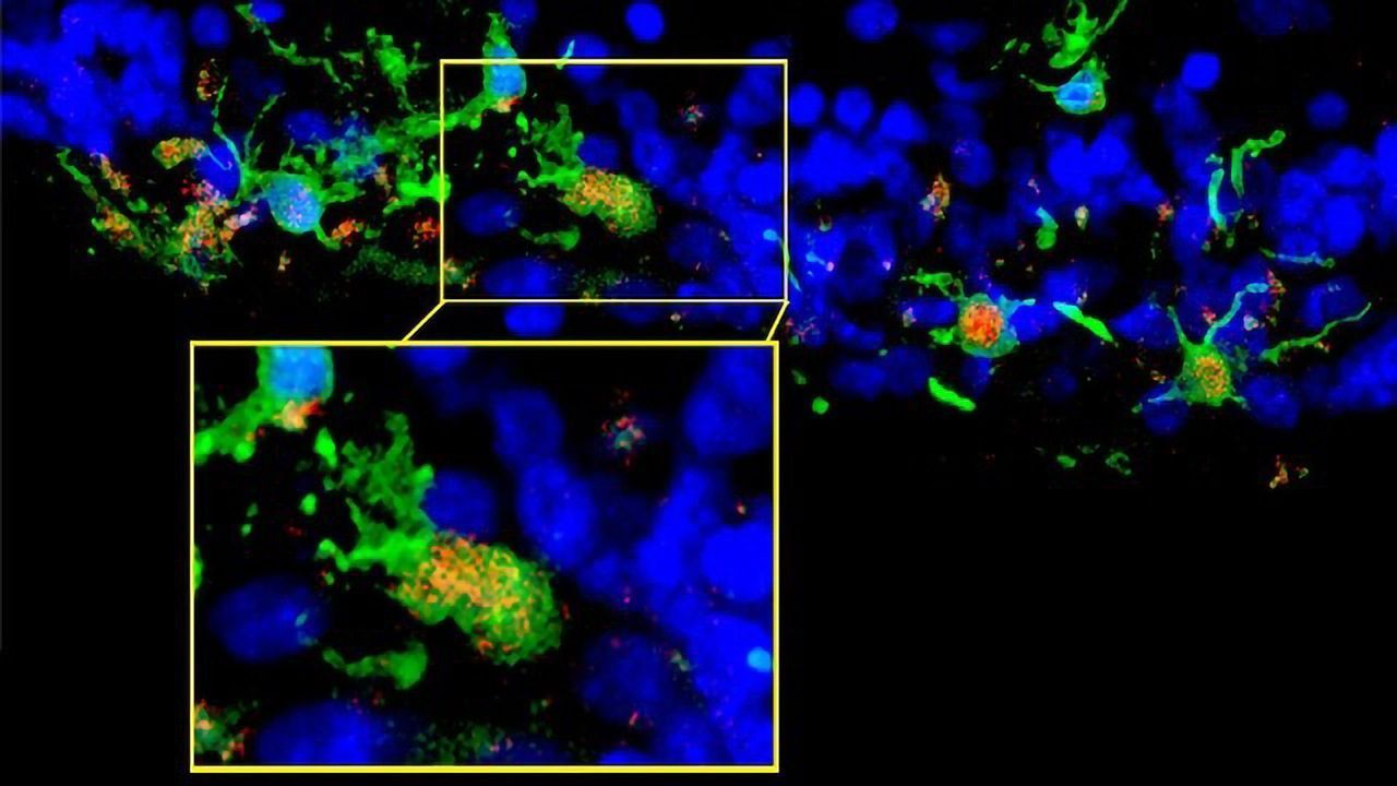 Immune System Can Slow Degenerative Eye Disease