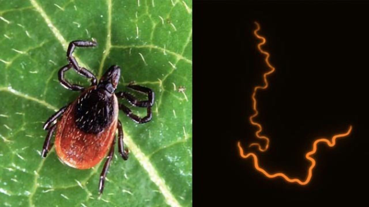 Cellular Component That Contributes to Lyme Arthritis Uncovered