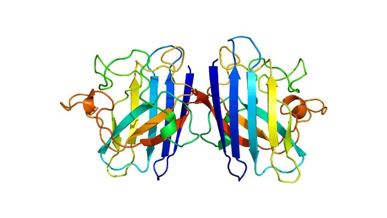 Antioxidant Overwhelmed by Tau in the Alzheimer's Brain