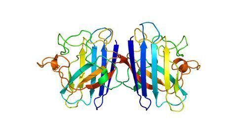Antioxidant Overwhelmed by Tau in the Alzheimer's Brain