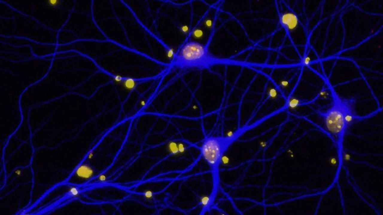 Alzheimer's Protein Segment Plays the Hero in the Mouse Brain