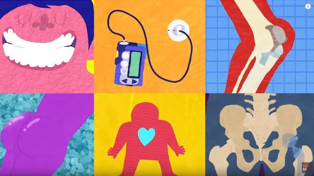 Your Body vs. Implants