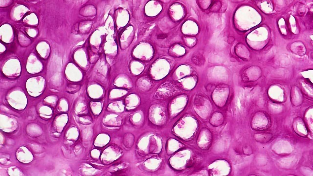 Drug Boosts Bone Growth in Children With Dwarfism in Four-year Study