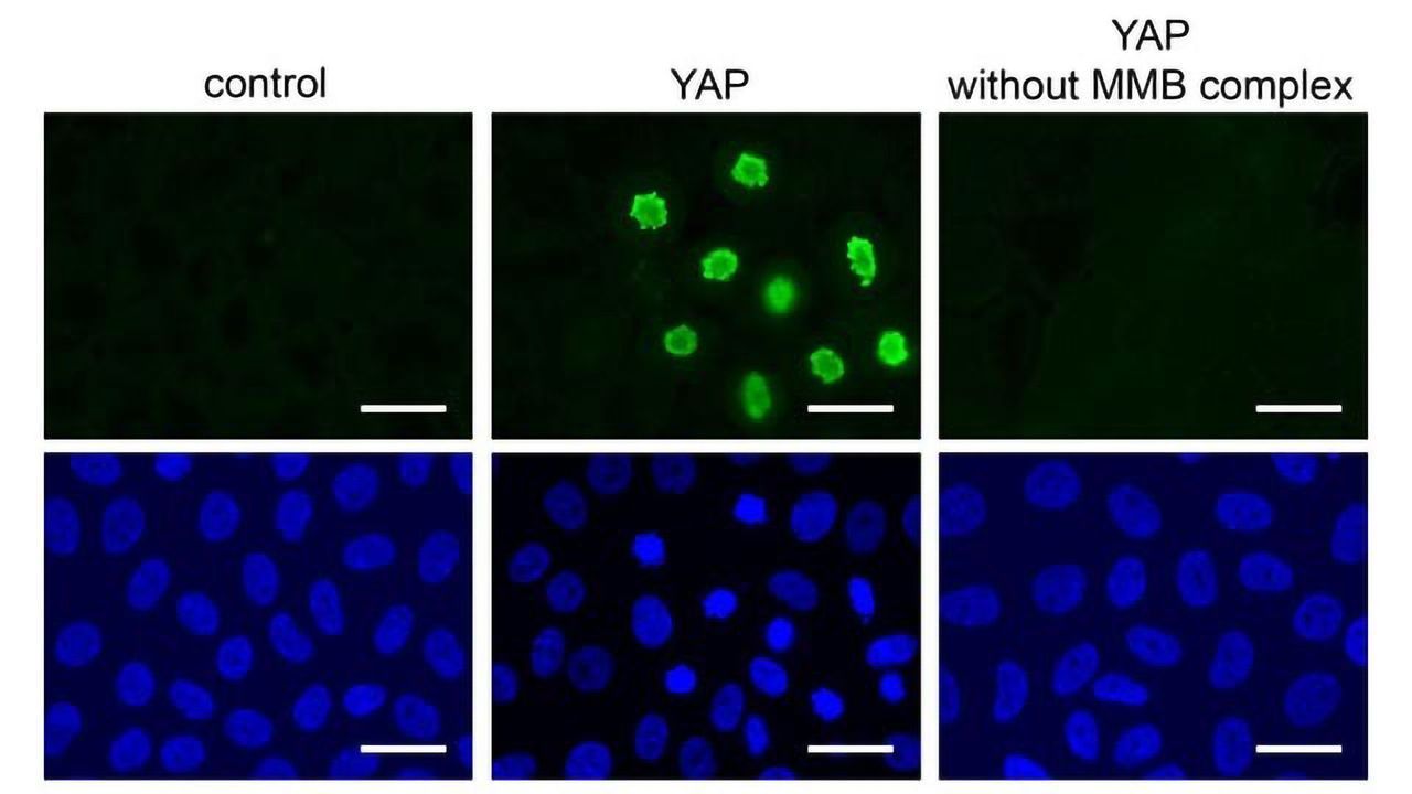 Targeting High-speed Cell Division in Cancer Cells