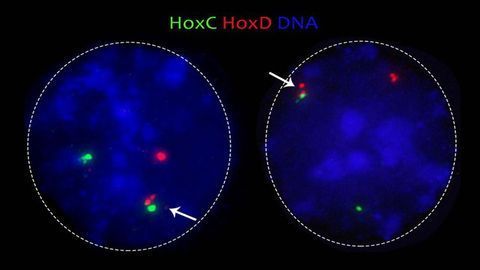 A New Role for Cohesin Protein in Tumors and Rare Diseases?
