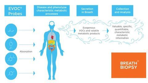 Owlstone Medical Announces a Novel Approach to Breath-Based Testing for Investigation of the Onset, Progression, and Treatment of Disease