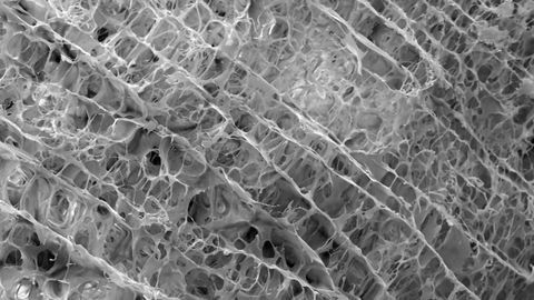Scaffold Derived From Pigs Aids Repair of Torn Miniscus