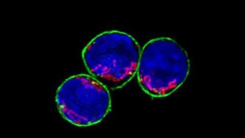 Chilled and Feisty Immune Cells Reside in the Gut