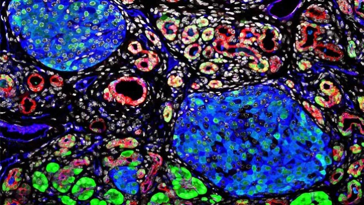 A Sweet Surprise: Targeting Sugar-coated Proteins to Treat Pancreatitis