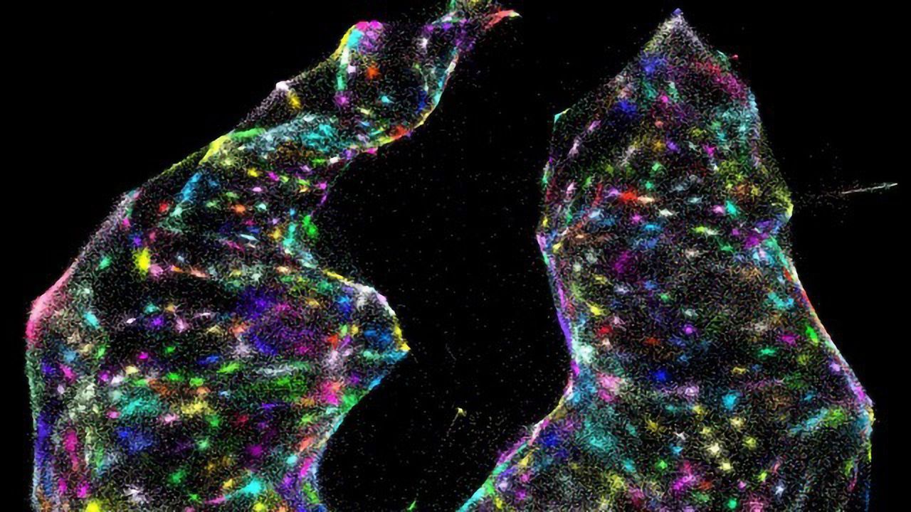 Microscopy Gets Reinvented