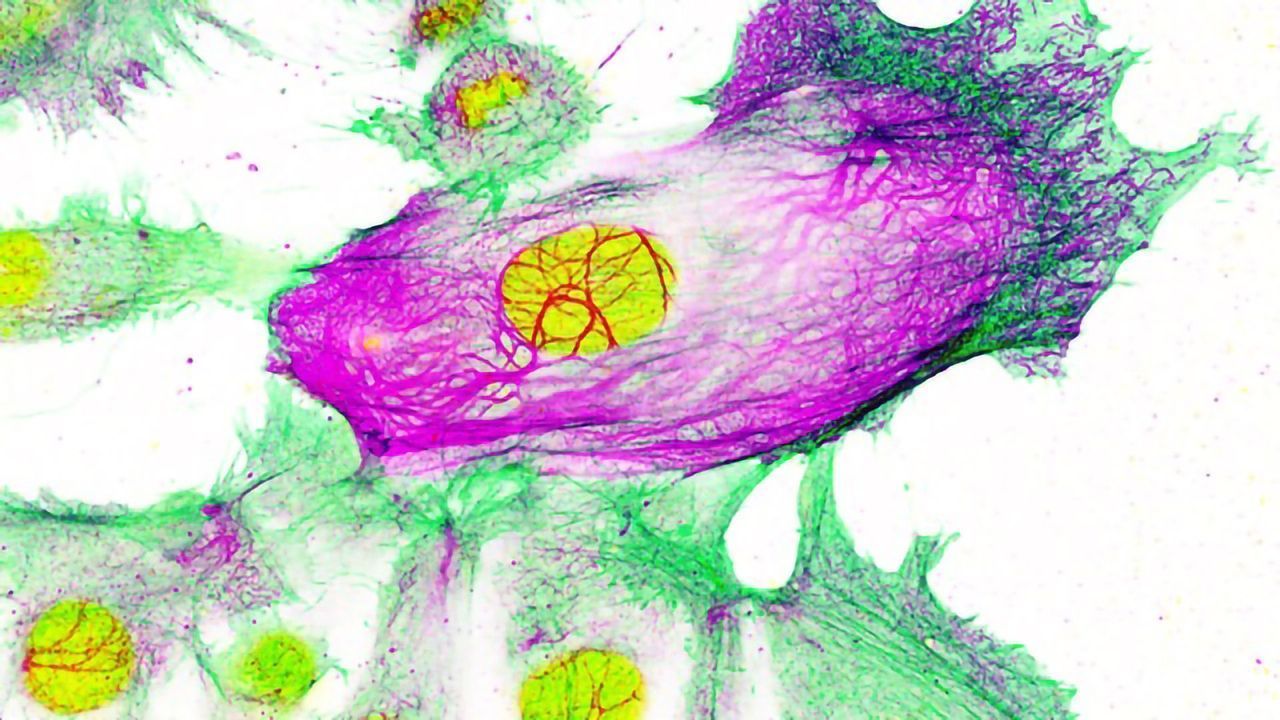 Drug-resistant Breast Cancer Cells