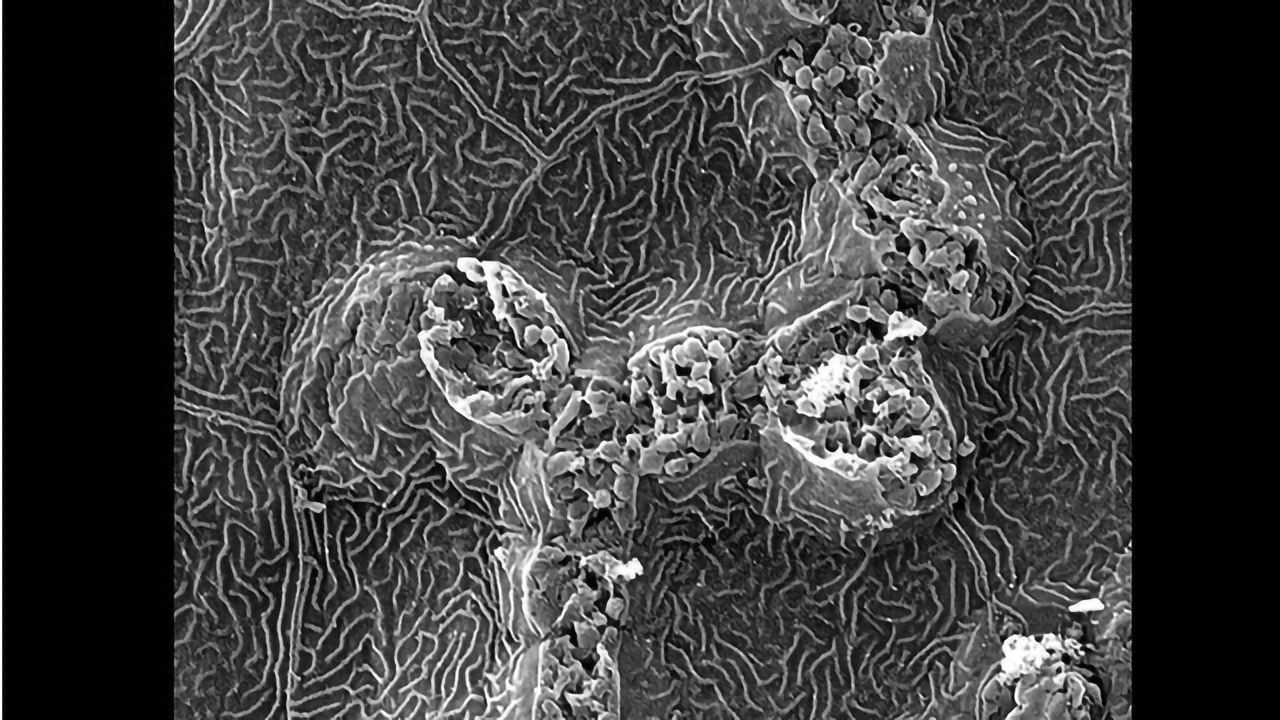 Cancer Cells Leaving Tracks