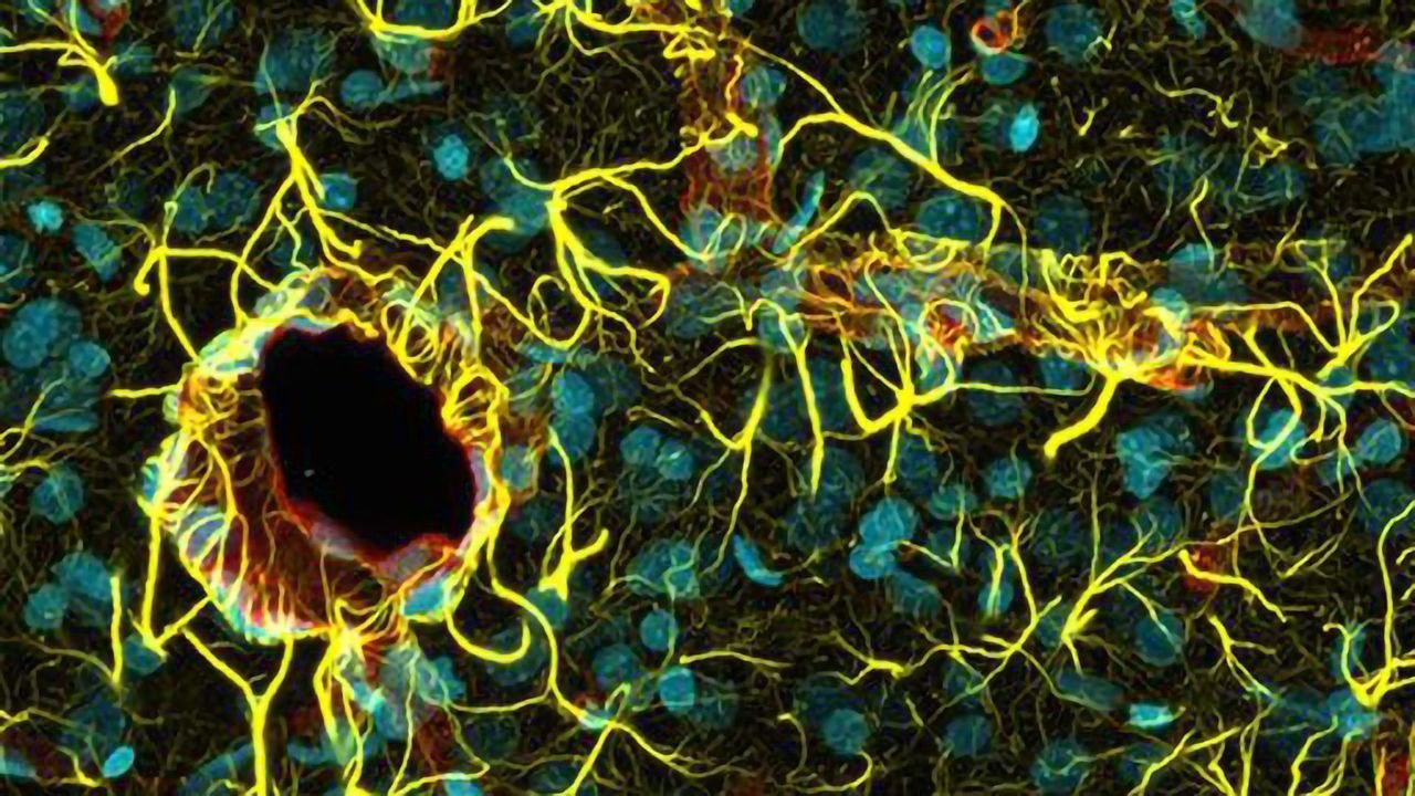 Astrocytes