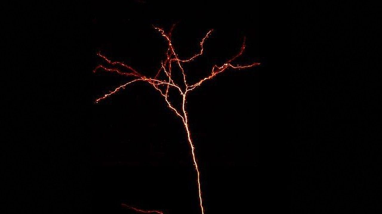 Autism Gene Linked to Changes Occurring Around Symptom Onset