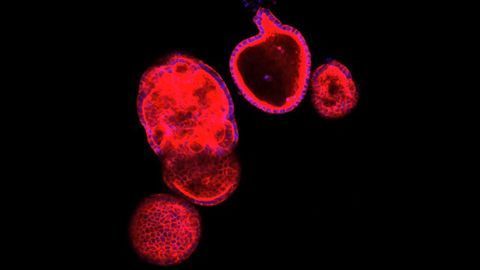 Organ-on-Chips and Organoids: Best of Both Worlds