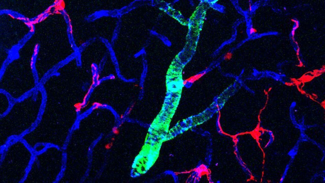 Pericytes Secretions Protect Against Leaky Brains in Mouse Model