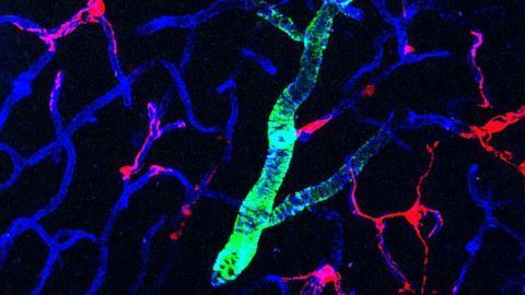 Pericytes Secretions Protect Against Leaky Brains in Mouse Model