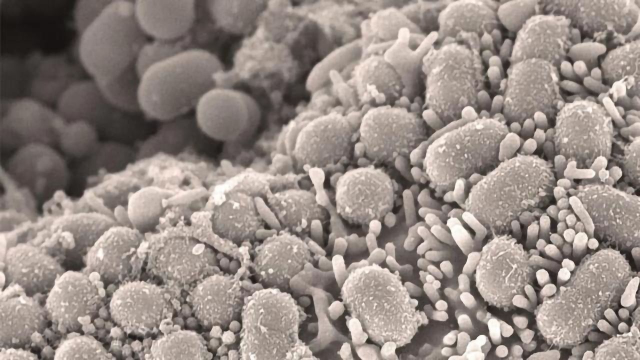 Widely Available Antibiotics Could Be Used to Treat “Superbug” MRSA